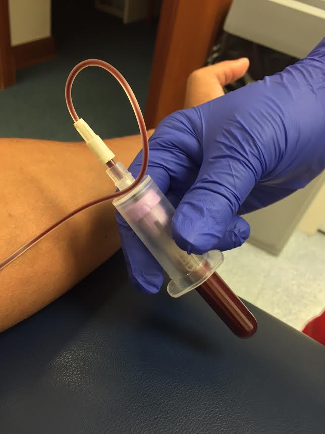 vile of blood allergy test